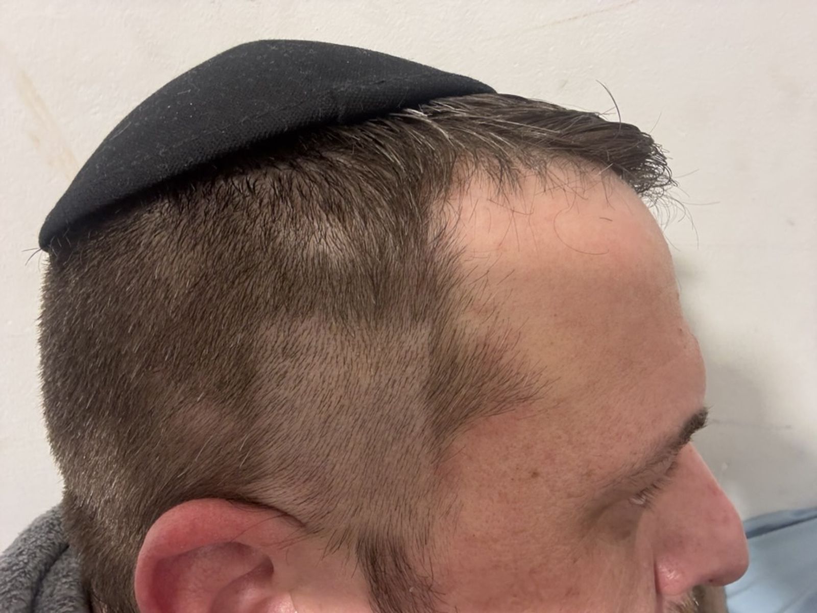 A Bad Hair Week